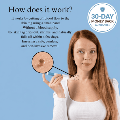 Precision Skin Tag Remover